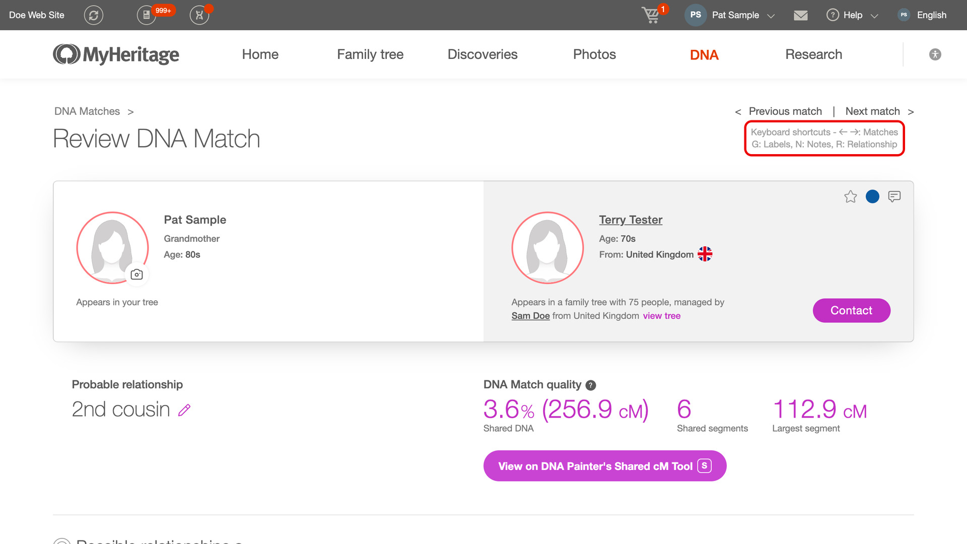 The top of a MyHeritage Review DNA Match page, with the two Keyboard shortcuts lines under the Previous match and Next match links outlined in red, listing the arrow keys for matches and G, N and R for labels, notes and the relationship.